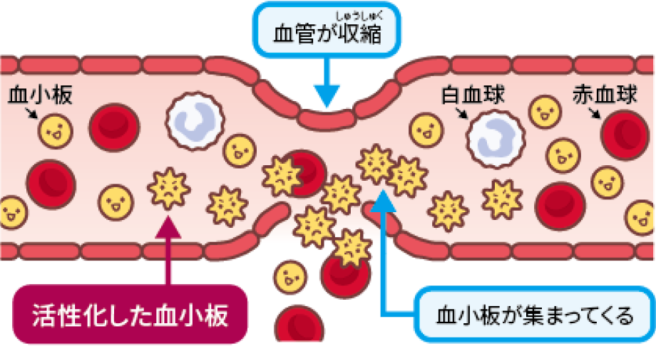 止血のしくみ：一次止血と二次止血(1)