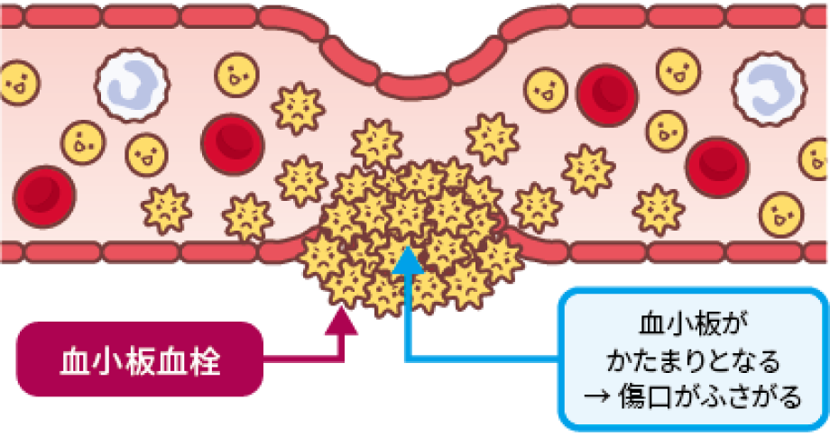 止血のしくみ：一次止血と二次止血(2)