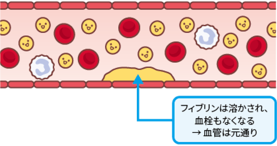 止血のしくみ：一次止血と二次止血(4)