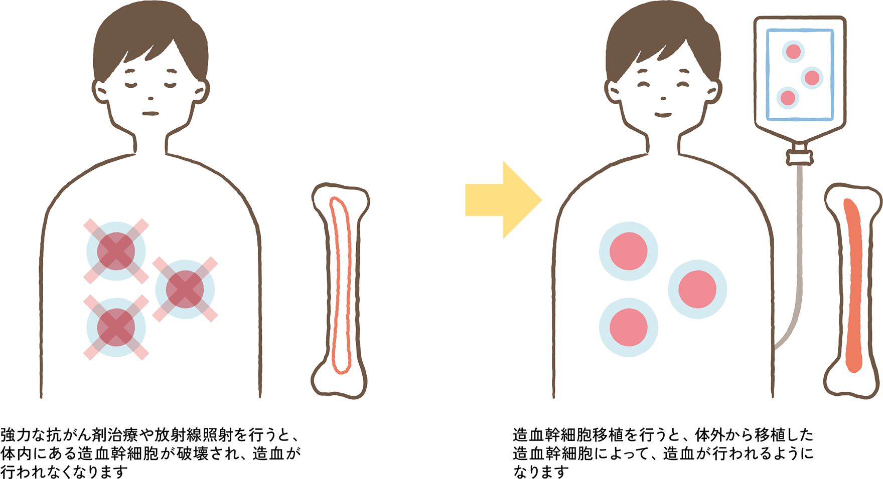 図2. 造血幹細胞移植がもたらす主な効果