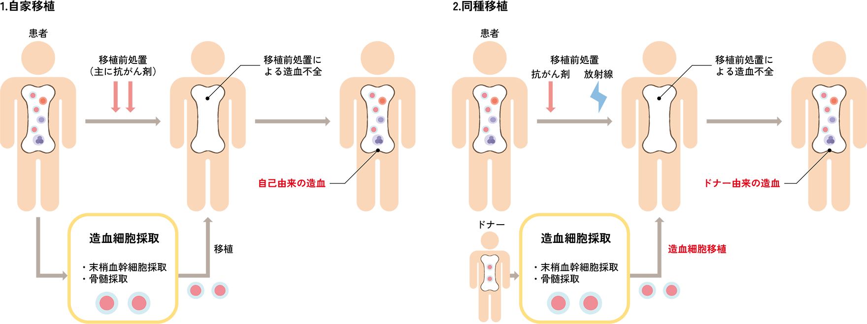 図. 「自家造血幹細胞移植」（自家移植）と「同種造血幹細胞移植」（同種移植）