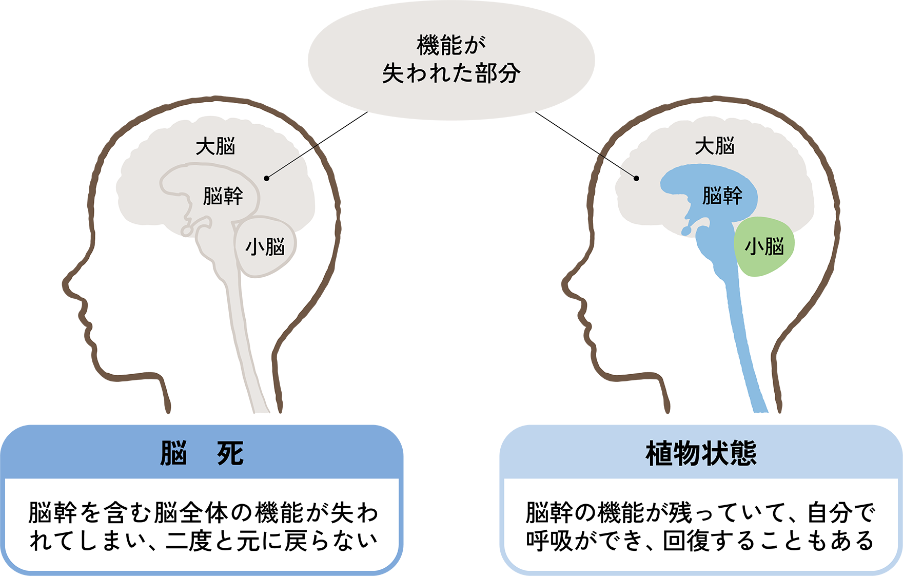 図2. 「脳死」と「植物状態」の違い