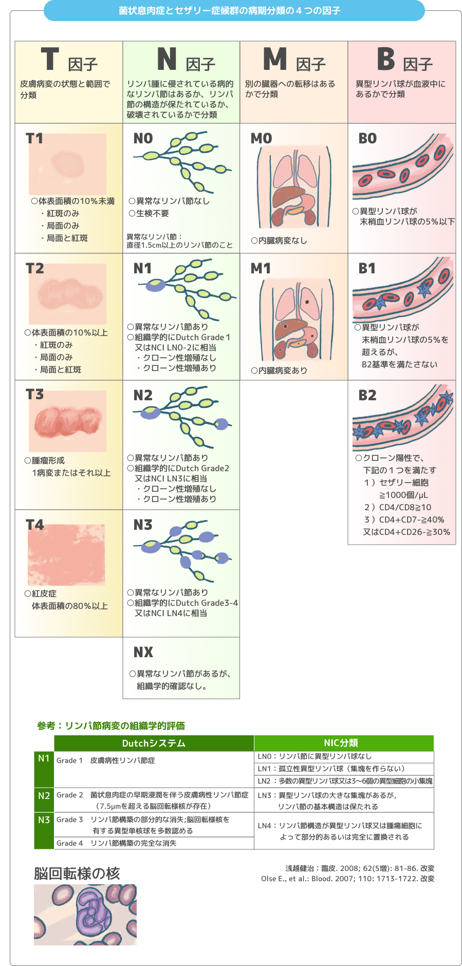 菌状息肉腫症とセザリー症候群の病期分類の４つの因子