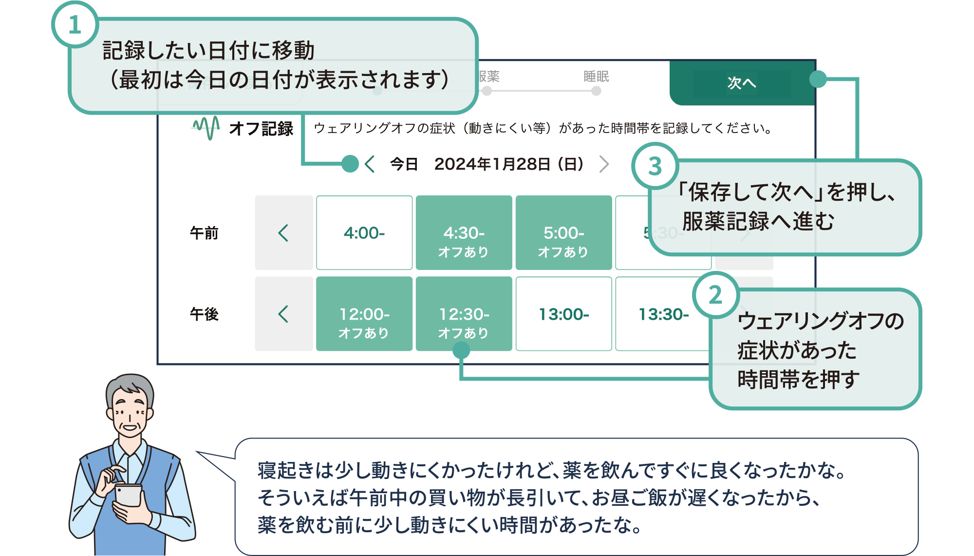 オフ記録（ウェアリングオフ症状があった時間帯の記録）