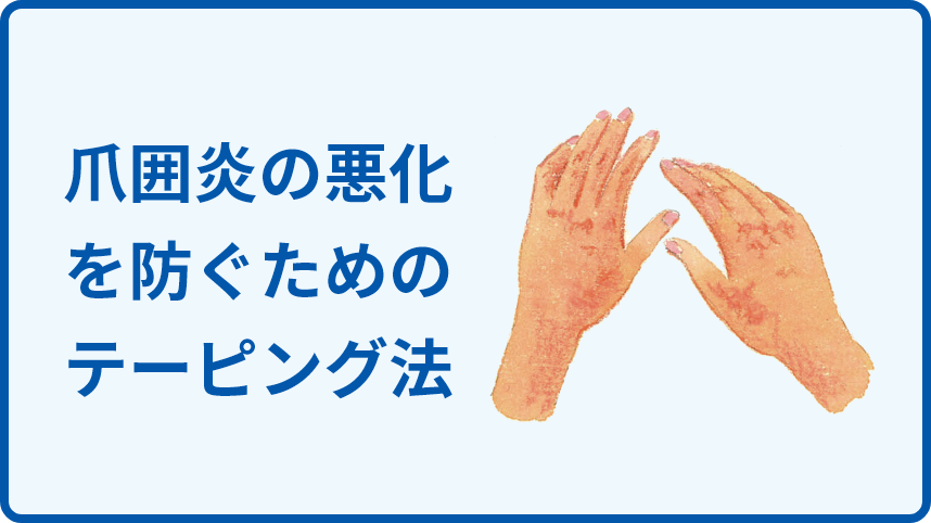 爪囲炎の悪化を防ぐためのテーピング法