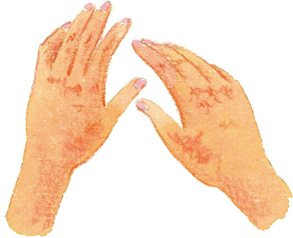ベクティビックス®の副作用として皮膚障害（皮膚の乾燥やひび割れ）について解説